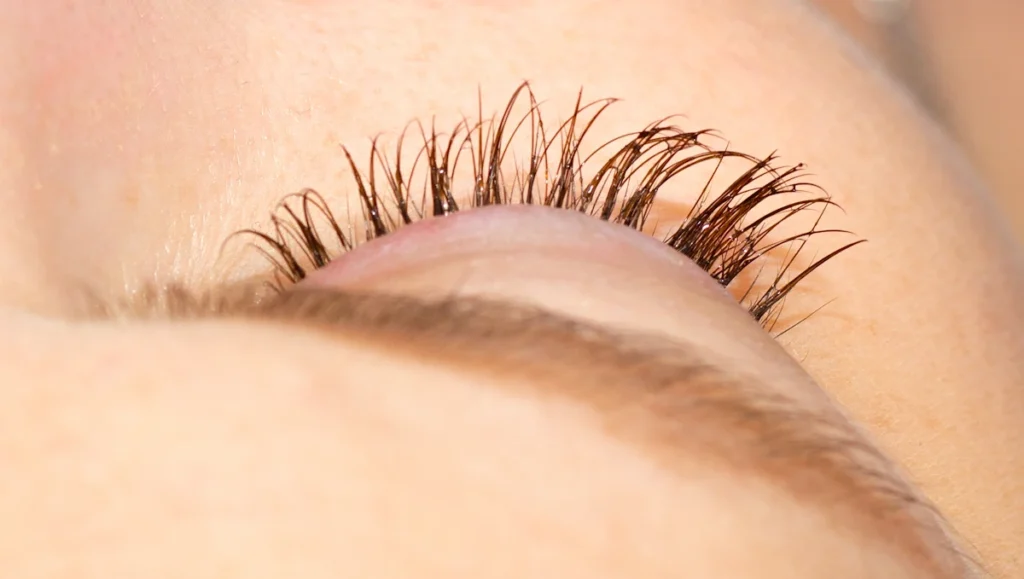 Voici pourquoi Ton implantation des cils te pose problème