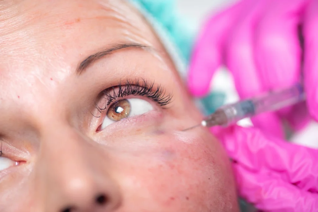 Voici les avis et retours sur le botox paupières tombantes