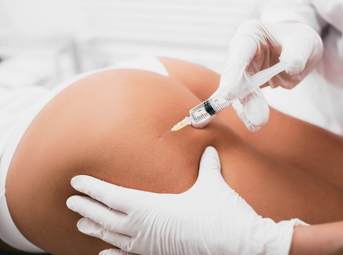 Voici les avis sur les injections hyaluronique fessiers